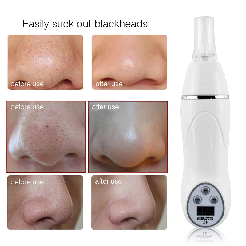 Handheld Diamond Microdermabrasion 3 Levels Machine Blackhead Acne Removal Facial Skin Care Peeling Cleaning Wrinkle Care Tool