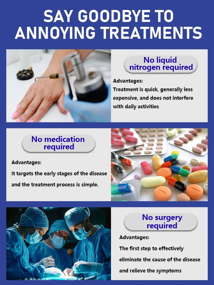 Laser Wart Remover Pen