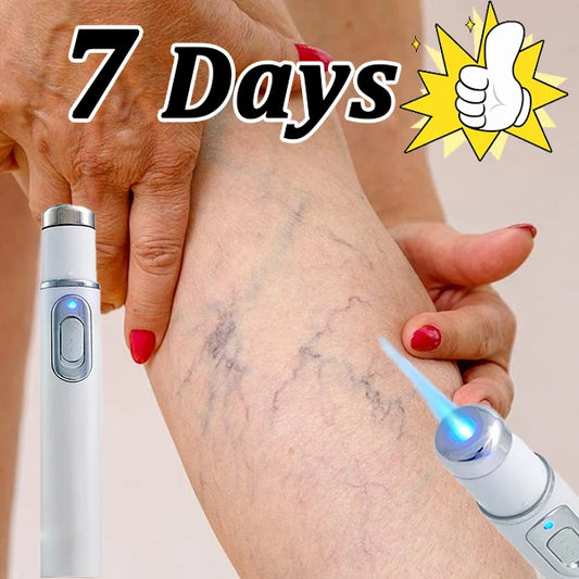 Blue light therapy for varicose veins in the legs, leg care tools