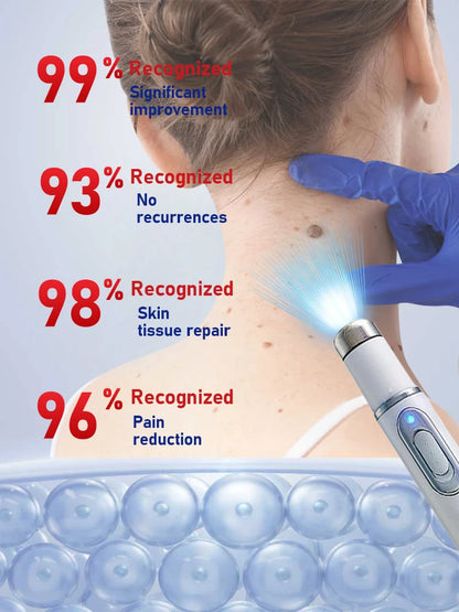 Laser Wart Remover Pen