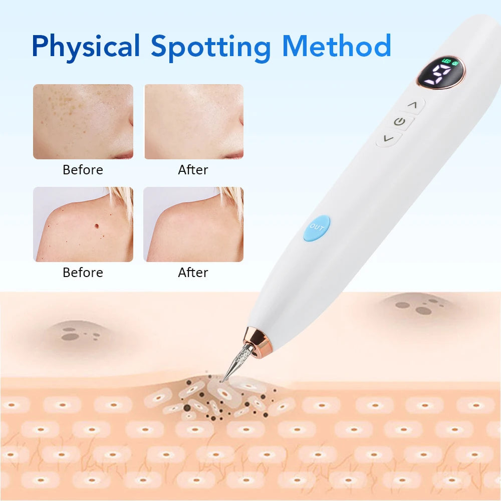 Skin Tag Remover Warts Eliminator Lcd Plasma Pen Papillomas Electric Laser Tattoo Removal Freckle Dark Spot Mole Cauterizer Kit