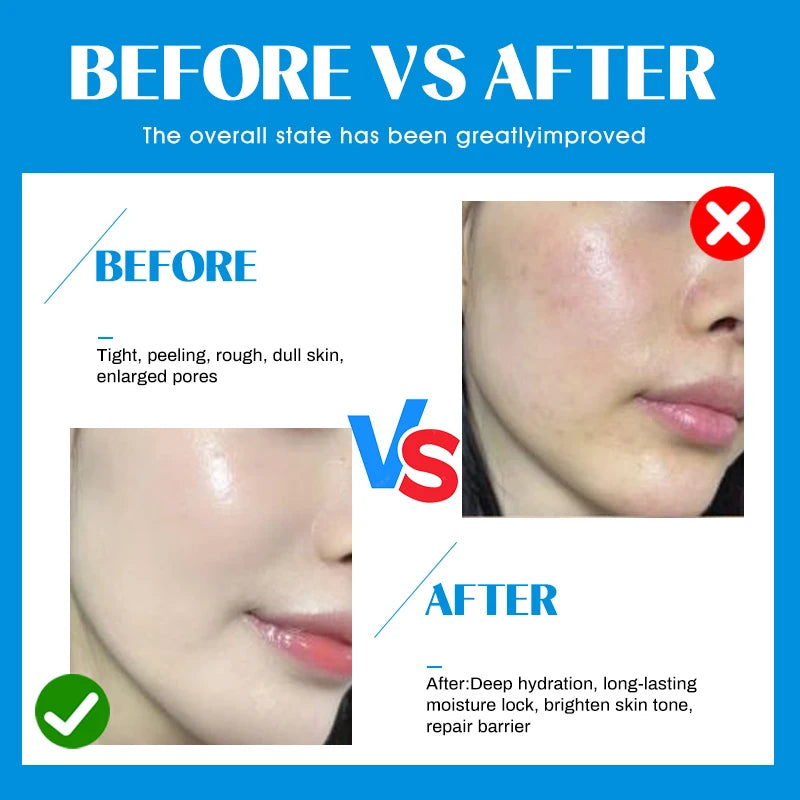 10Vials Hyaluron Acid Ampoule Serum for Facial Dr.Pen Micronneed Retinol EGF Peptide VC Snail Mucin Moisturizing Skin Care