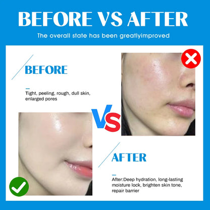 10Vials Hyaluron Acid Ampoule Serum for Facial Dr.Pen Micronneed Retinol EGF Peptide VC Snail Mucin Moisturizing Skin Care