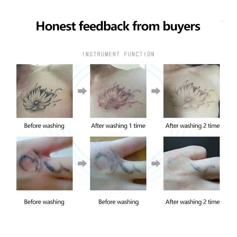 Picosecond Laser Pointer for Mole Removal Dark Spot Removal Pen tattoo Acne Skin Pigment Portable Removal Machine Beauty