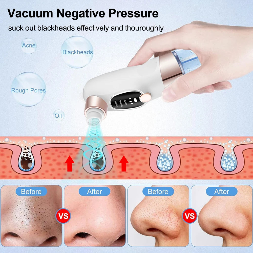 Rechargeable Blackhead Remover Vacuum Facial Pore Cleaner Electric Pimple Blackhead Cleaner Deep Dirt Cleaning Machine for Skin