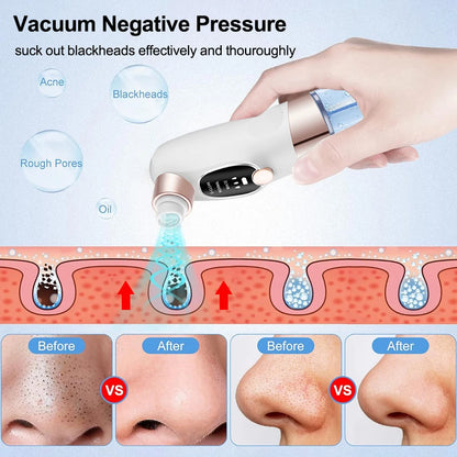 Rechargeable Blackhead Remover Vacuum Facial Pore Cleaner Electric Pimple Blackhead Cleaner Deep Dirt Cleaning Machine for Skin