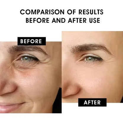 Hoygi Blue Copper Peptide Serum Anti Wrinkles Aging Rejuvenating Facial Lifting Moisturizing Brighten Skin Tone Skin Cosmetics