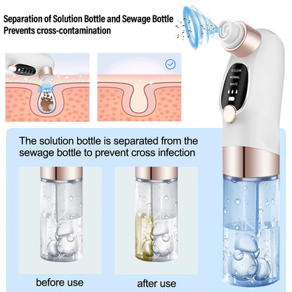 Rechargeable Blackhead Remover Vacuum Facial Pore Cleaner Electric Pimple Blackhead Cleaner Deep Dirt Cleaning Machine for Skin