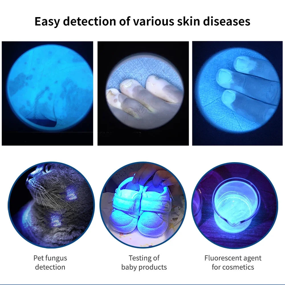 Medical Grade Led Wood Lamp Skin Analysis Magnifying Glass White Spot Detection Fungus Detection Instrument