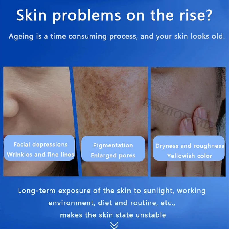 80% Blue Sponge microalgae Kit Face Collagen Regeneration Natural Biological Extract Sponge Spicules Resurfacing Skin Care