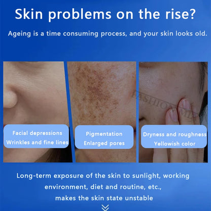 80% Blue Sponge microalgae Kit Face Collagen Regeneration Natural Biological Extract Sponge Spicules Resurfacing Skin Care