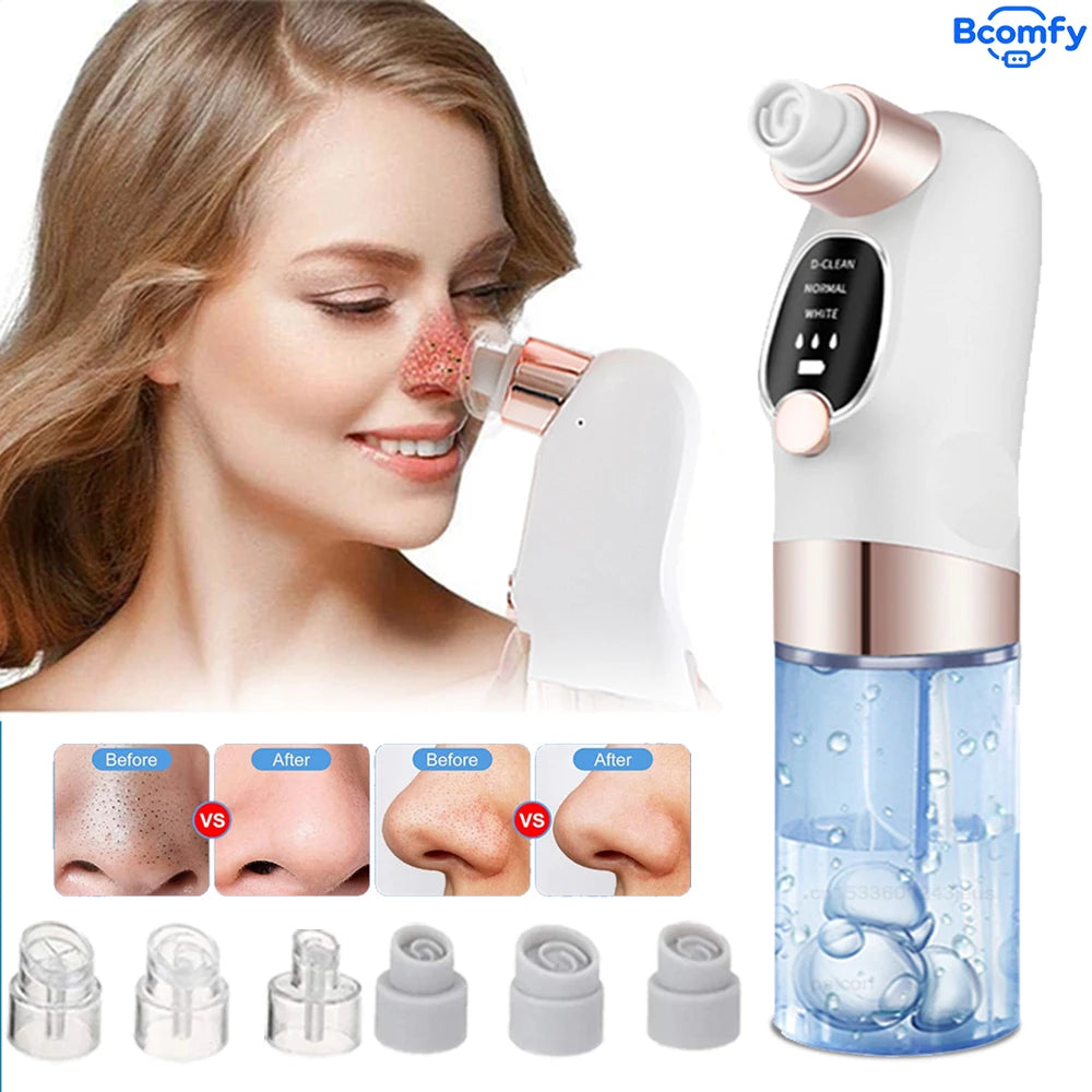 Rechargeable Blackhead Remover Vacuum Facial Pore Cleaner Electric Pimple Blackhead Cleaner Deep Dirt Cleaning Machine for Skin
